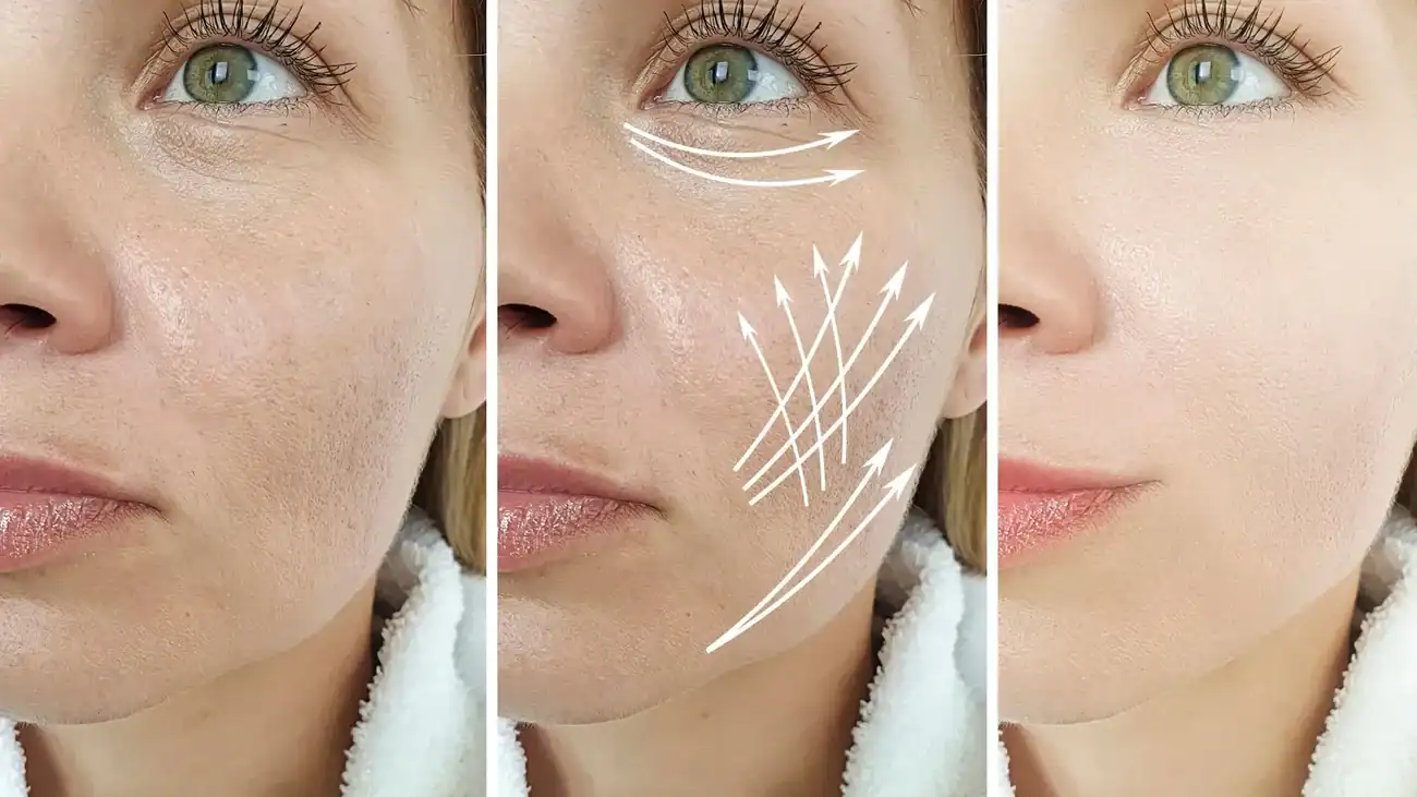 Can One Treatment Really Tackle More Than One Skin Concern Kent?