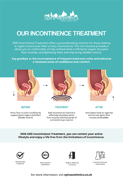 image to show how EMS treatment works for female urinary incontinence Kent