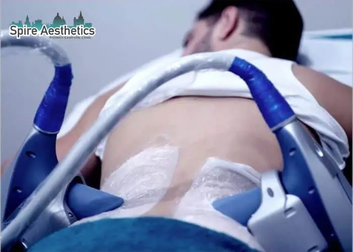 Man having fat freezing treatment done on love handles before a competitions Kent to create a sculpted look.