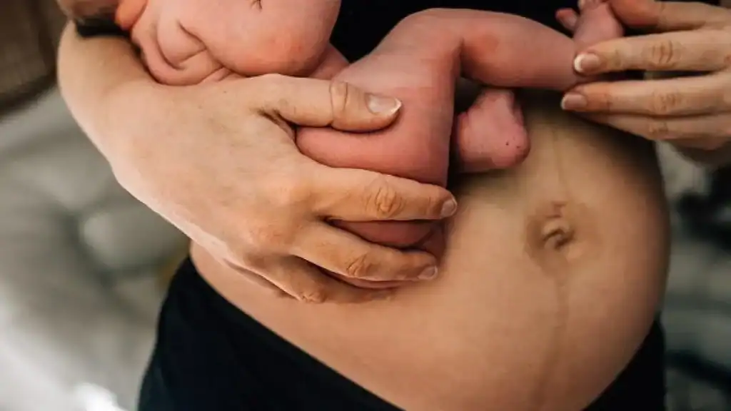 Why Is My Stomach Still Big After Pregnancy Kent?